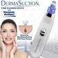 Dermasuction – 4 in 1 Blackhead Whitehead Extractor | AURUM