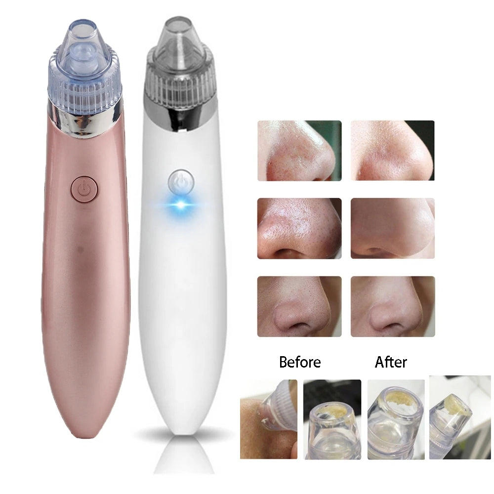 Vacuum Pore Cleaner & Blackhead Remover